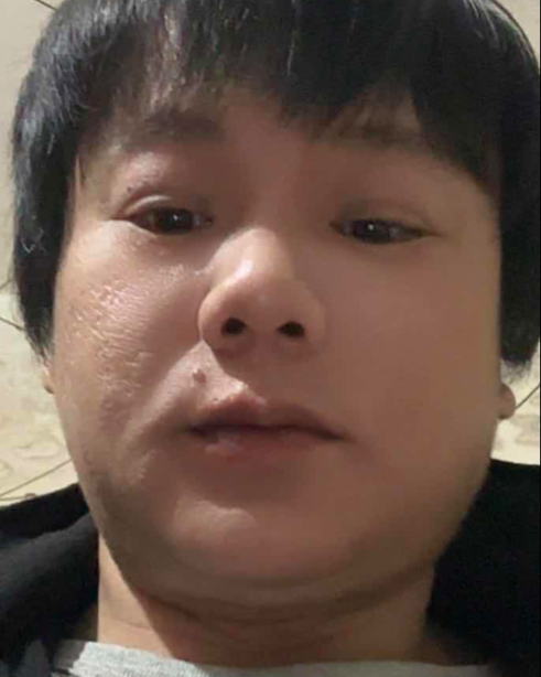 随